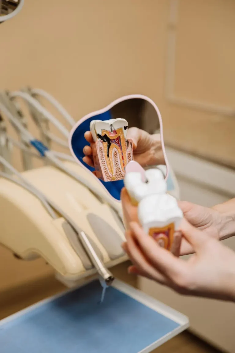 Kiedy potrzebne jest leczenie kanałowe-Leczenie Kanałowe Pod Mikroskopem Lublin-dr Marzena Pucek-Klinika Pięknego Uśmiechu-2